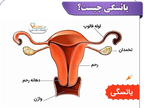 یائسگی؛ هر آنچه باید درباره علائم، تشخیص و درمان بدانید
